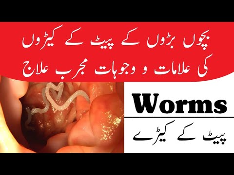 Wormsبچوں بڑوں کے پیٹ کے کیڑوں کی علامت وجوہات علاج