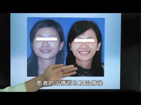 矯正 美容牙科