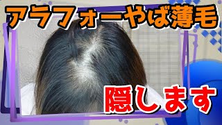 サムネが1番閲覧注意ww部分ウィッグどこまで隠せる！？アラフォー若作り動画part3は…ヤバ薄毛隠します！！