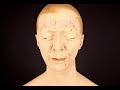 How to Clear Acne Overnight -Get Rid Of Acne Fast How to Clear Acne Overnight -Get Rid Of Acne Fast