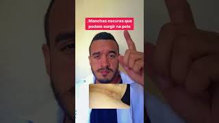 Manchas Escuras No Pescoço. Diabete?