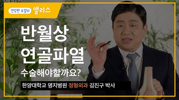 반월상 연골 파열, 수술이 꼭 필요할까요?