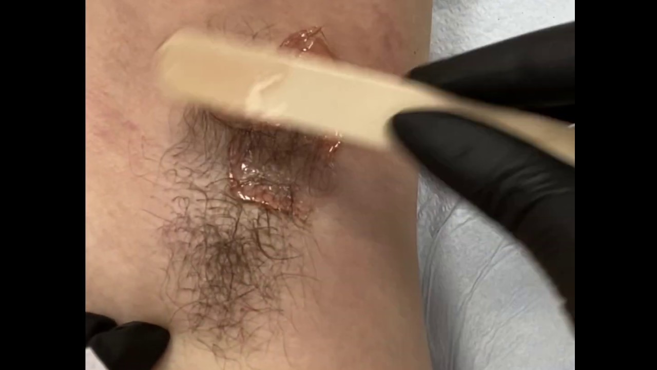 Waxing Or Sugaring Underarm Hair Removal Is The Best Youtube