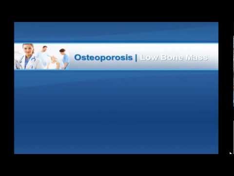 osteoporosis-treatment-|-an-easy-&-effective-way-to-get-rid-of-osteoporosis-naturally!