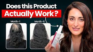 Does this product actually work? Dermatologist explains #HairGrowthSerum