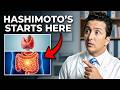 How to Heal Hashimoto's From Within — It Starts in Your Gut