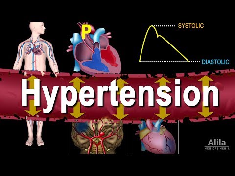 Video: Hypertension And Hypertension: Differences, What Is The Difference, What Stages, Video