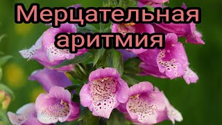 Мерцательная аритмия, как лечить? Народная медицина. Целитель. Травник.