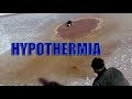 HYPOTHERMIA