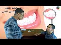 اجمد فيديو ضحك 2017 كوميديا الدكتور عبدالشكور الامور