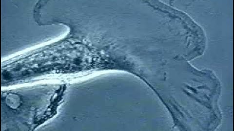 Fibroblast under microscope