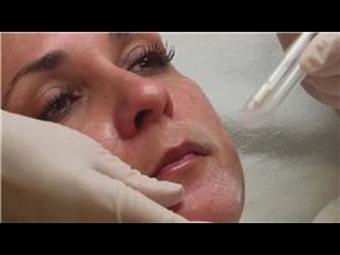 Acne Prone Skin Care : How Do I Peel Skin With Salicylic Acid