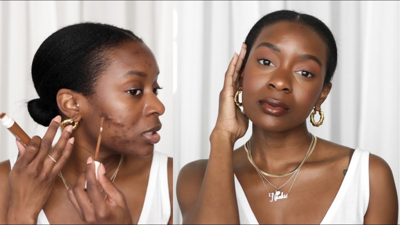 how to cover acne scars without makeup