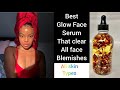 FACE GLOW SERUM FOR ALL SKIN BLEMISHES AND PROBLEMS, CLEAR PIMPLES, ACNE, EZCEMA, DARKSPOTS