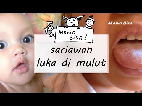 Video: Stomatitis Pada Anak-anak - Apa Yang Harus Dilakukan? Bagaimana Cara Merawatnya? Fitur Pengobatan Pada Anak-anak