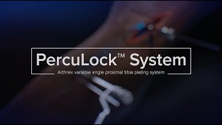 PercuLock™ System Animation @WhatsNewinOrthopedics