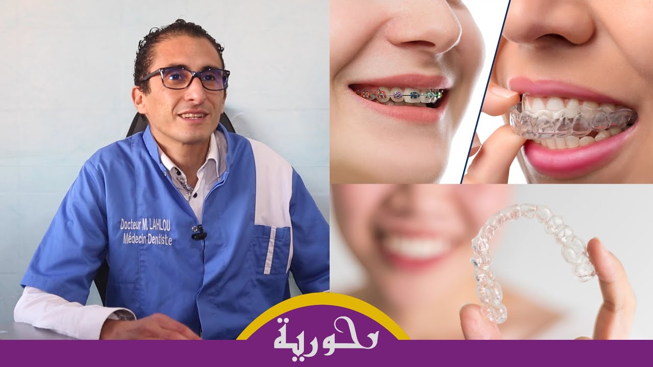 الفرق بين التقويم الشفاف والتابث.. الجودة ومدة العلاج تختلف واحذرو من إشهارات الأنستغرام!