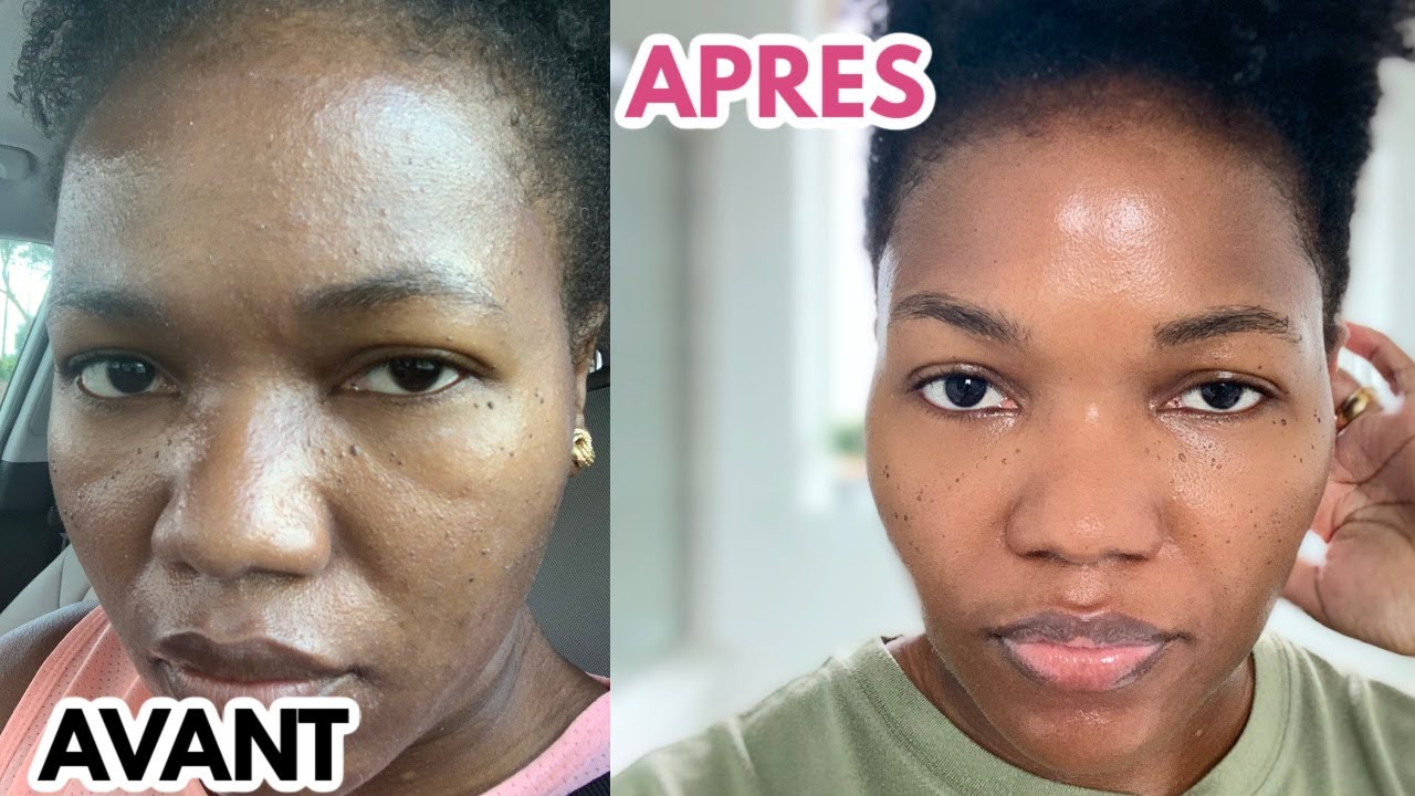 Utilise Ceci Pour 1 Visage Lisse Claire Sans Tâches Et Boutons Peau