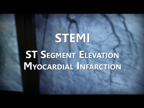 NHRMC Heart Center   STEMI Training Video