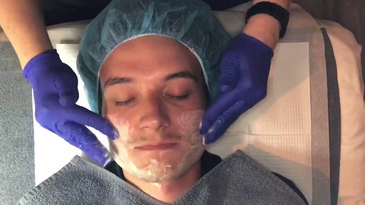 Men’s Acne Treatment YouTube