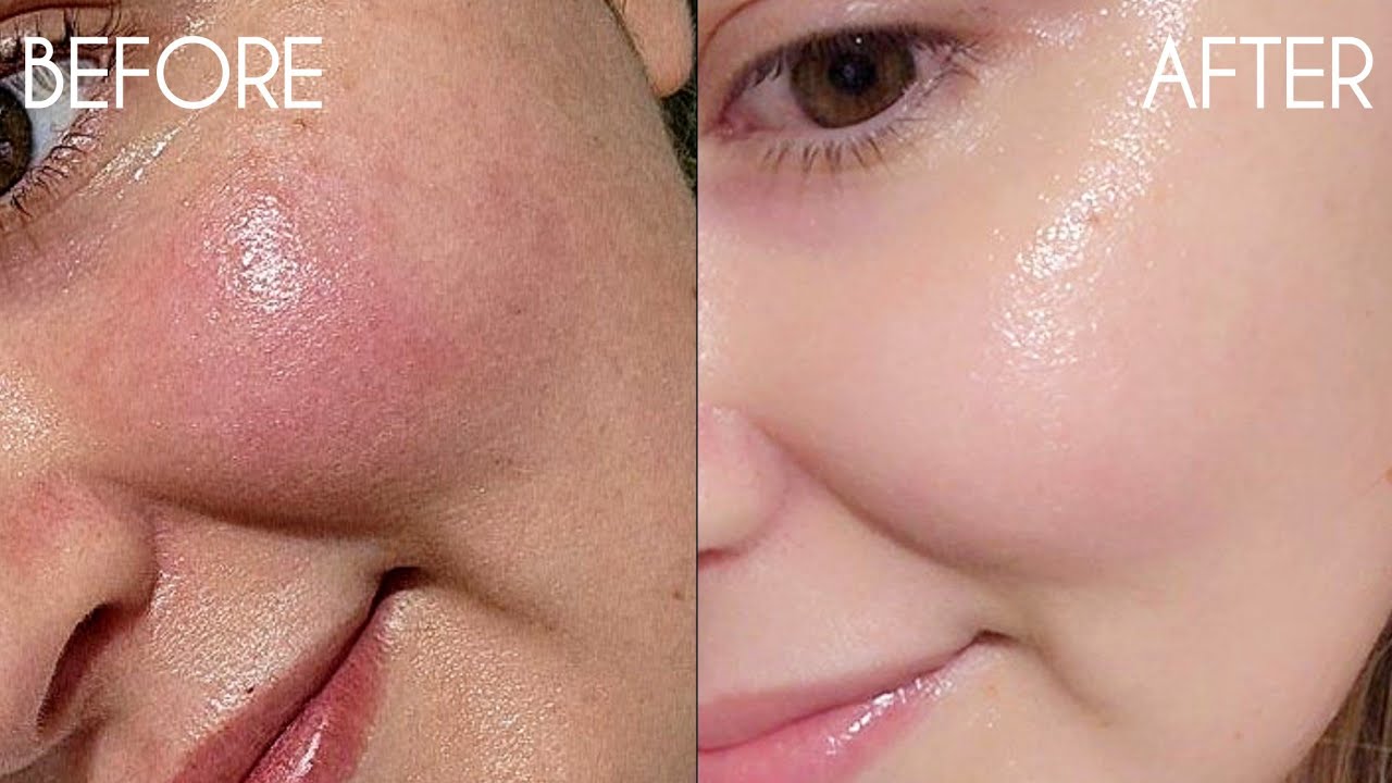 The Best Affordable Skincare For Teens