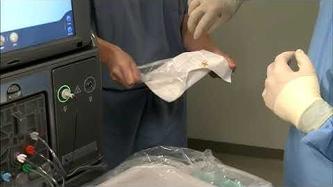 Alcon Constellation Fragmentation Function Setup