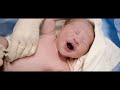 Parto Cesárea - Nascimento Davi - Hospital Gênesis