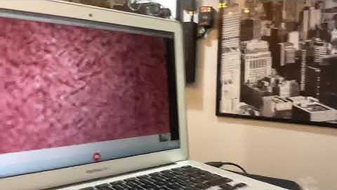 Scalp Micropigmentation Up Close using a Microscope High Picel