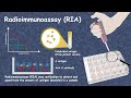 Radioimmunoassay ria