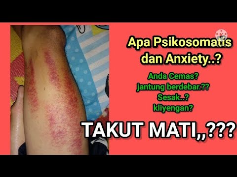 Tips Mengobati Anxiety/Psikosomatis, Sesak, Takut mati, jantung