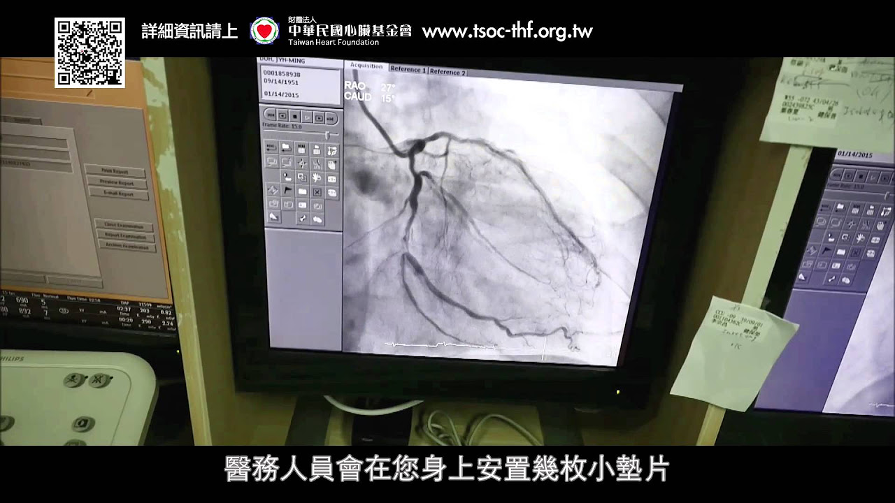 換季時的隱形殺手 別輕忽心血管的警訊【醫學大聯盟】2021.11.29