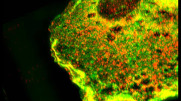 Super resolution imaging showing P-Rex1 and Norbin colocalisation