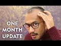 Hair Transplant | 1 Month Post Surgery | Shedding Phase