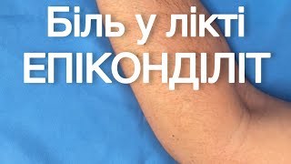 Біль в лікті - латеральний епікондиліт або «лікоть тенісиста». 👉лікування завдяки електростимуляції.
