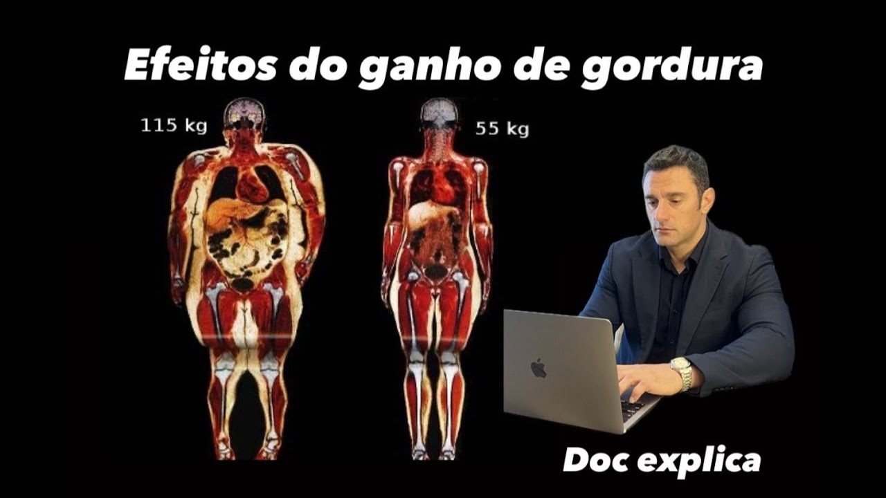 GANHO DE GORDURA CORPORAL: QUAIS SÃO AS CONSEQUÊNCIAS NA SAUDE?