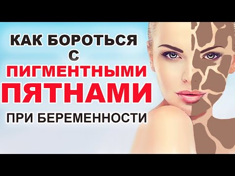 Видео: Как избежать пигментации кожи во время беременности (с иллюстрациями)