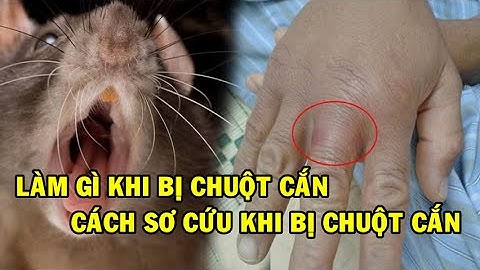 Làm gì khi bị chuột cắn | Sơ cứu khi bị chuột cắn