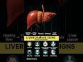 😱 8 Early Signs of Liver Damage You Should Never Ignore | Liver Damage #shorts #shortsfeed