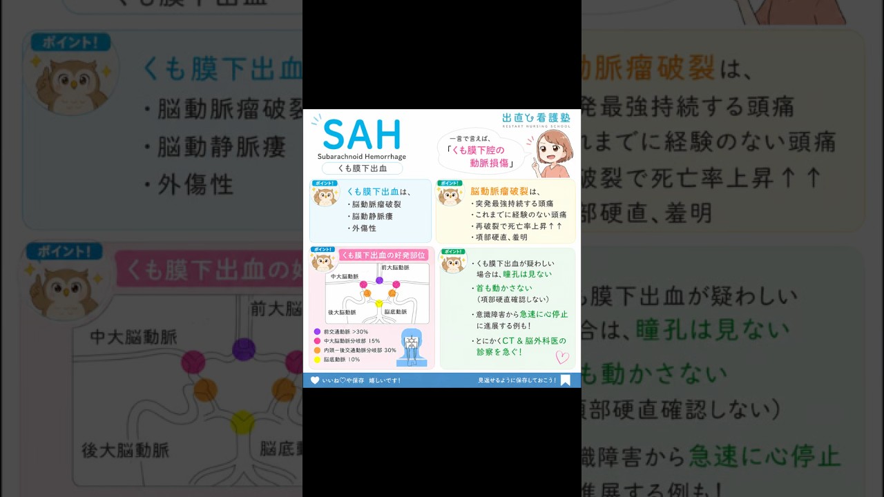【フィジカルアセスメント認定士試験・解説動画】SAH#看護師 #特定看護師 #出直し看護塾 #診療の補助の強化書 #切り抜き