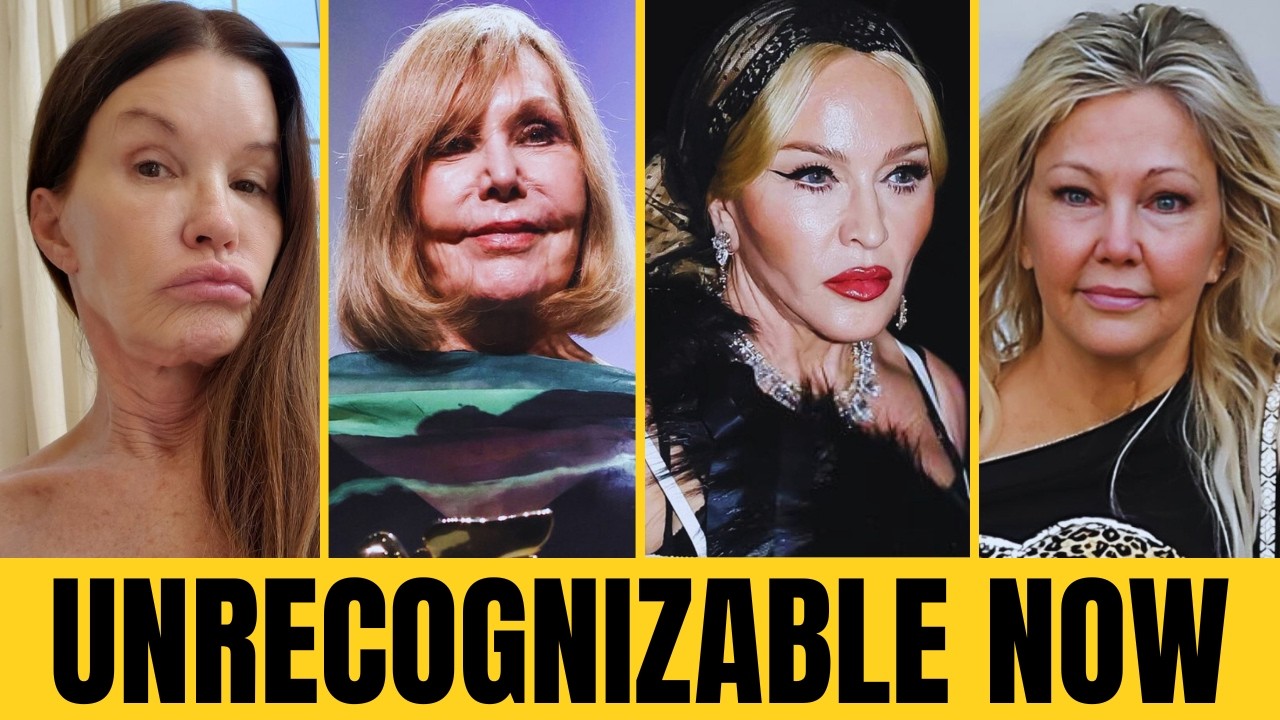 15 Celebrity Plastic Surgery Stories That Surprised Everyone  | Then and Now 2026