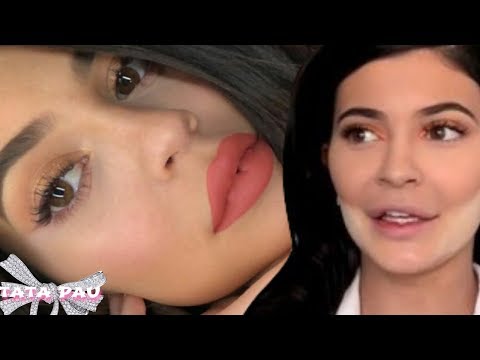 Vidéo: Kylie, Arrête! Les Lèvres Et Les Pommettes De Jenner Grossissent. Commentaire D'expert