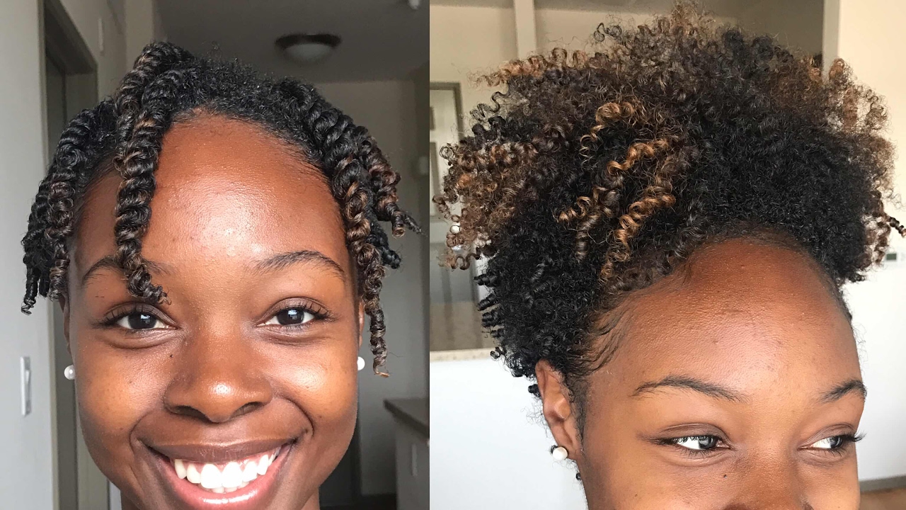 5 Tips for Getting Through The Awkward Phases of PostChemo Hair Growth