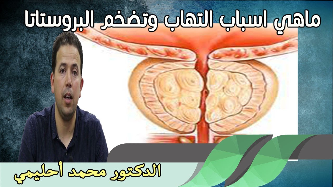 ماهي اسباب التهاب وتضخم البروستاتا كيف تحمي نفسك من خلال تغذيتك الدكتور محمد احليمي