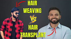 Hair Transplant Youtube