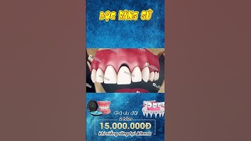 [3D] BỌC RĂNG SỨ || Nha Khoa Quốc Tế Athena