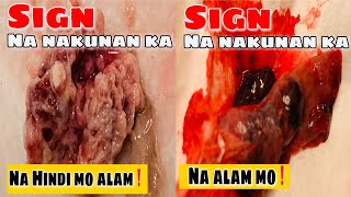 BUNTIS NAKUNAN NA HINDI ALAM PAANO MALALAMAN ANG MGA  SENYALES AT SINTOMA #buntis #paano miscarriage