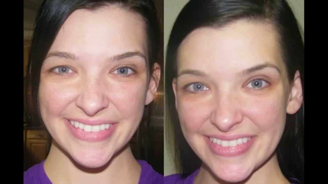 dermology anti aging vélemények