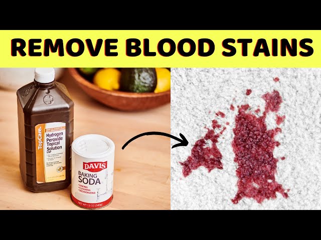 How To Remove Dried Blood Stains From Carpet With Baking Soda And Hydrogen  Peroxide 