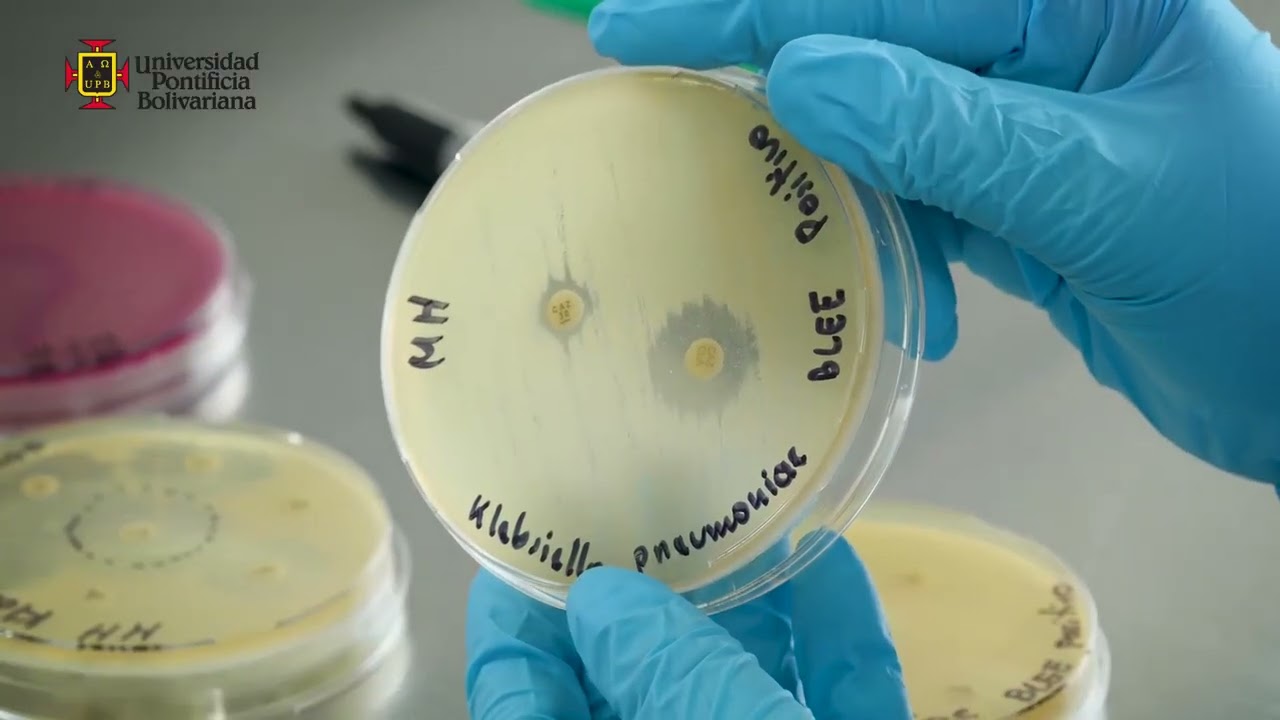 Mecanismos de resistencia de las bacterias y pruebas para su detección en el laboratorio