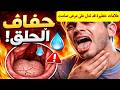 جفاف الحلق وصعوبة بلع الريق واش بسبب القولون العصبي اومرض السكري متحتاجيش تحاليل ولا تخسري فلوسك 